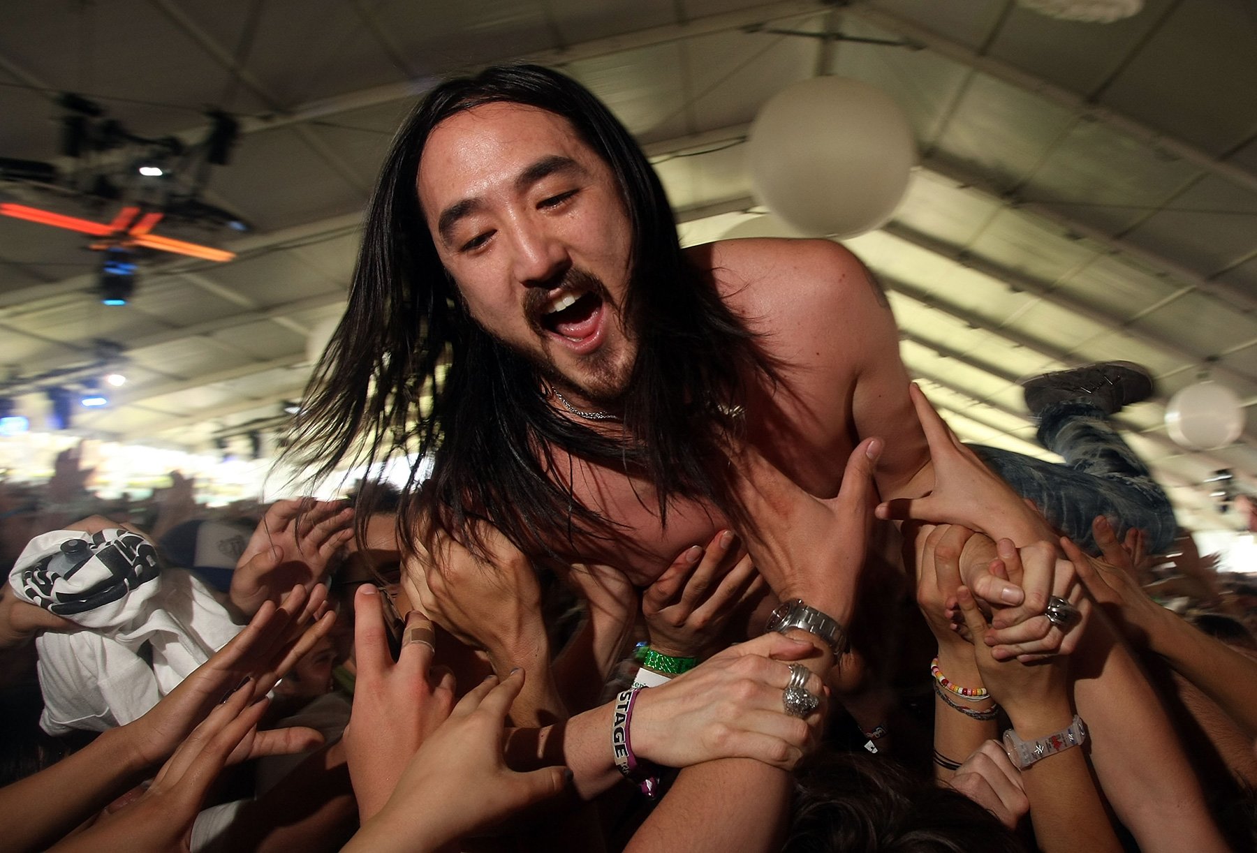 Steve Aoki Cancels Shows for Emergency Vocal Surgery